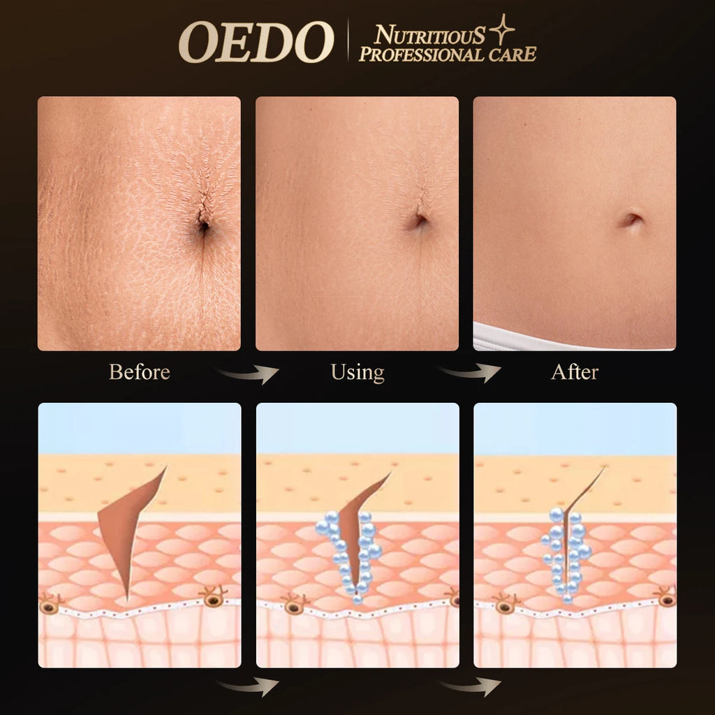 OEDO Nourishing Body Lotion – Skin Elasticity Restoring Moisturizer for Women