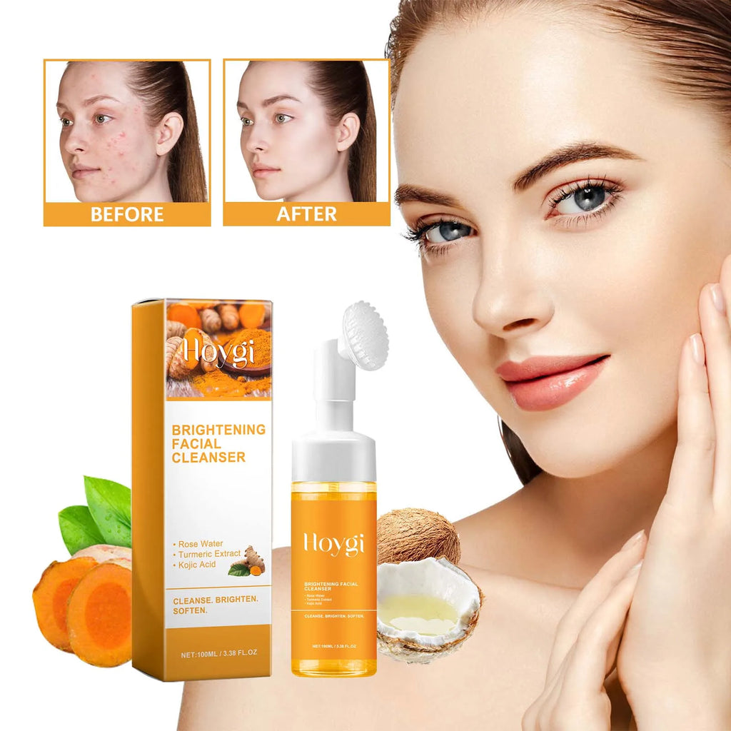 Turmeric Kojic Acid Face Wash – Deep Cleansing Brightening Oil Control Cleanser