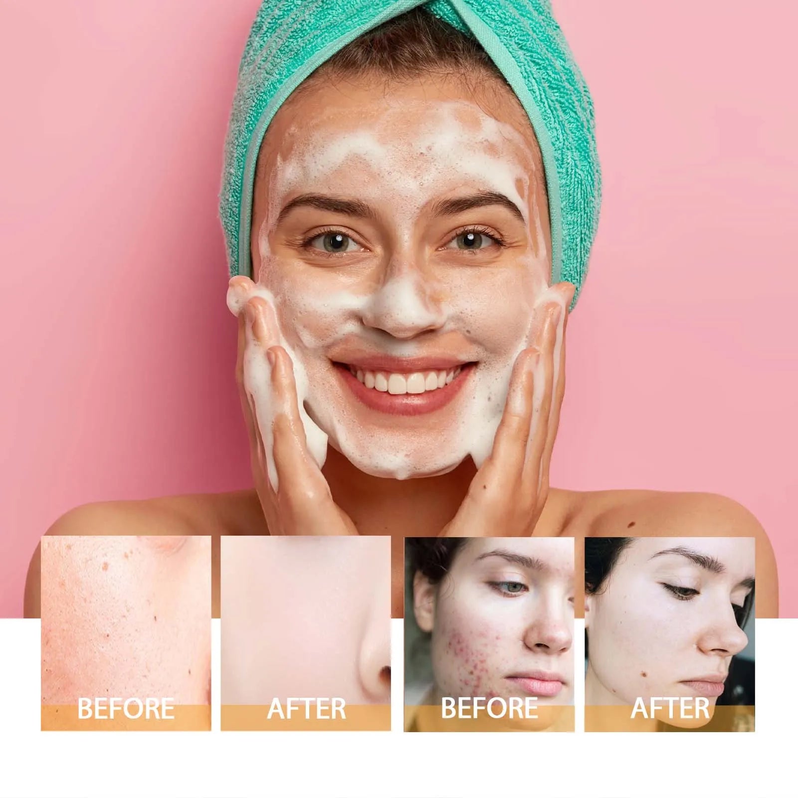 Turmeric Kojic Acid Face Wash – Deep Cleansing Brightening Oil Control Cleanser