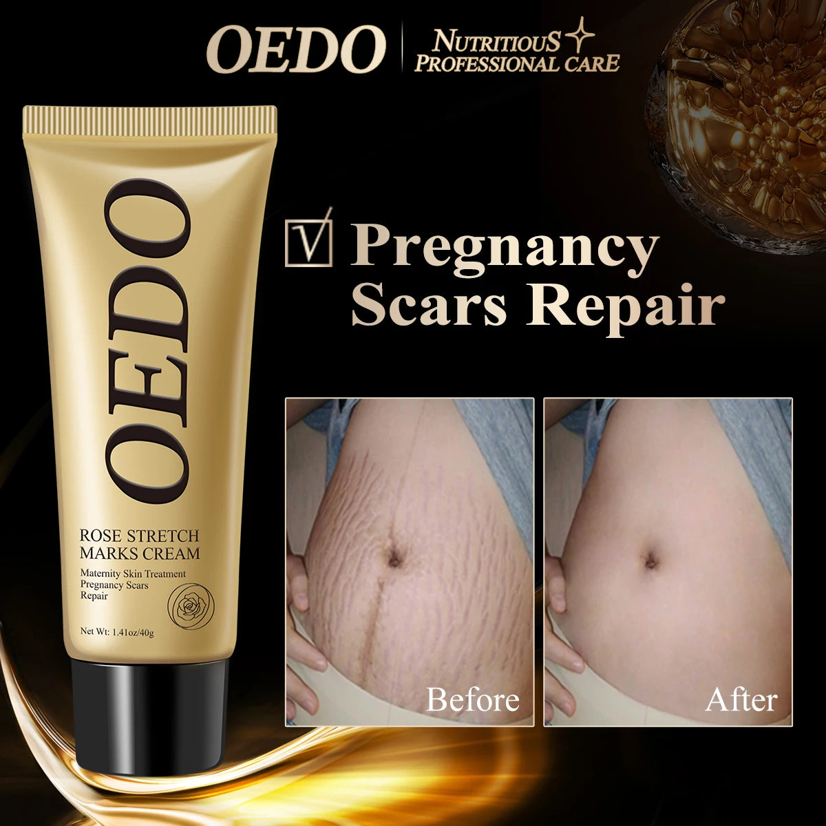 OEDO Nourishing Body Lotion – Skin Elasticity Restoring Moisturizer for Women