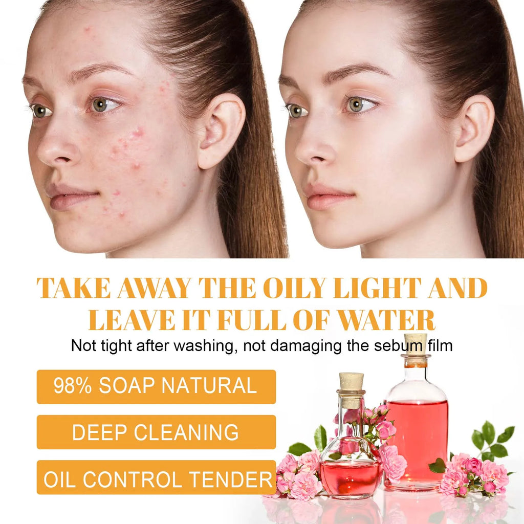 Turmeric Kojic Acid Face Wash – Deep Cleansing Brightening Oil Control Cleanser